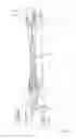 Fig. 66 - Surface cleaning apparatus