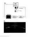 Fig. 01 - Optical coherence elastography to assess biomechanics and detect progression of ocular and other tissues degenerative diseases