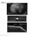 Fig. 05 - OPTICAL TOMOGRAPHY DEVICE