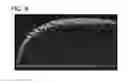Fig. 08 - OPTICAL TOMOGRAPHY DEVICE