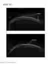 Fig. 11 - OPTICAL TOMOGRAPHY DEVICE