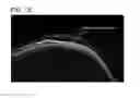 Fig. 12 - OPTICAL TOMOGRAPHY DEVICE
