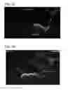 Fig. 14 - OPTICAL TOMOGRAPHY DEVICE