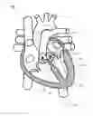 Fig. 01 - SYSTEM AND APPARATUS COMPRISING A MULTISENSOR GUIDEWIRE FOR USE IN INTERVENTIONAL CARDIOLOGY