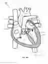 Fig. 18 - SYSTEM AND APPARATUS COMPRISING A MULTISENSOR GUIDEWIRE FOR USE IN INTERVENTIONAL CARDIOLOGY