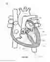 Fig. 19 - SYSTEM AND APPARATUS COMPRISING A MULTISENSOR GUIDEWIRE FOR USE IN INTERVENTIONAL CARDIOLOGY