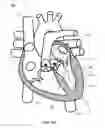 Fig. 21 - SYSTEM AND APPARATUS COMPRISING A MULTISENSOR GUIDEWIRE FOR USE IN INTERVENTIONAL CARDIOLOGY
