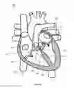 Fig. 23 - SYSTEM AND APPARATUS COMPRISING A MULTISENSOR GUIDEWIRE FOR USE IN INTERVENTIONAL CARDIOLOGY