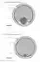 Fig. 34 - SYSTEM AND APPARATUS COMPRISING A MULTISENSOR GUIDEWIRE FOR USE IN INTERVENTIONAL CARDIOLOGY