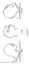Fig. 03 - Method and device for measuring intracranial pressure, ICP, in a subject