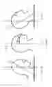 Fig. 07 - Method and device for measuring intracranial pressure, ICP, in a subject