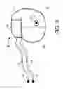 Fig. 04 - MEANS AND METHOD FOR THE DETECTION OF CARDIAC EVENTS
