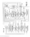 Fig. 06 - MEANS AND METHOD FOR THE DETECTION OF CARDIAC EVENTS