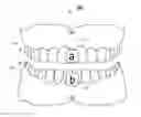 Fig. 01 - Three dimensional imaging of the motion of teeth and jaws