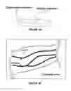 Fig. 04 - Imaging system and method for enhanced visualization of near surface vascular structures