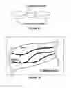 Fig. 05 - Imaging system and method for enhanced visualization of near surface vascular structures