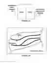 Fig. 07 - Imaging system and method for enhanced visualization of near surface vascular structures