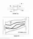 Fig. 09 - Imaging system and method for enhanced visualization of near surface vascular structures