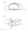 Fig. 05 - CPR chest compression monitor with reference sensor
