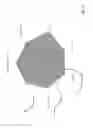 Fig. 03 - GRAPHICAL TECHNIQUE FOR DETECTING CONGESTIVE HEART FAILURE