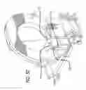 Fig. 11 - Radiological imaging device with improved functionality