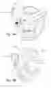 Fig. 16 - Radiological imaging device with improved functionality