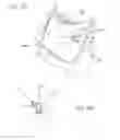 Fig. 02 - Sensor holding apparatus for facilitating dental imaging