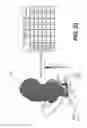 Fig. 16 - Method and system for image processing to determine patient-specific blood flow characteristics
