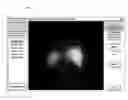 Fig. 01 - Systems and methods for determining hepatic function from liver scans