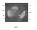 Fig. 07 - Systems and methods for determining hepatic function from liver scans
