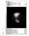 Fig. 10 - Systems and methods for determining hepatic function from liver scans