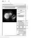 Fig. 12 - Systems and methods for determining hepatic function from liver scans