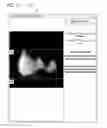 Fig. 14 - Systems and methods for determining hepatic function from liver scans