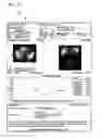 Fig. 18 - Systems and methods for determining hepatic function from liver scans