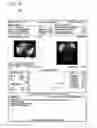 Fig. 19 - Systems and methods for determining hepatic function from liver scans