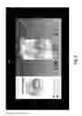 Fig. 10 - System for tracking and imaging a treatment probe