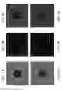 Fig. 12 - Retrieving high spatial frequency information in sonography