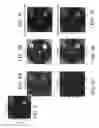 Fig. 13 - Retrieving high spatial frequency information in sonography