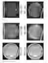 Fig. 17 - Retrieving high spatial frequency information in sonography