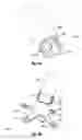 Fig. 11 - CLIP AND DEPLOYMENT APPARATUS FOR TISSUE CLOSURE