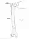 Fig. 04 - Method and apparatus for attaching tissue to bone, including the provision and use of a novel knotless suture anchor system, including a novel locking element