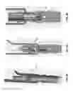 Fig. 58 - Method and apparatus for attaching tissue to bone, including the provision and use of a novel knotless suture anchor system, including a novel locking element