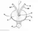 Fig. 01 - Flexible planar member for tissue fixation