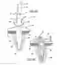 Fig. 06 - Flexible planar member for tissue fixation