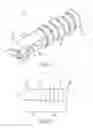 Fig. 02 - Knotless instability anchor