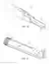Fig. 10 - Knotless instability anchor