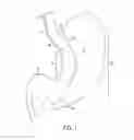 Fig. 02 - GASTRIC TRACTION DEVICE AND METHOD