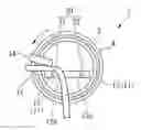 Fig. 01 - RETAINING DEVICE