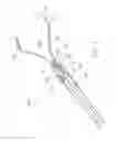 Fig. 02 - Device and method for through the scope endoscopic hemostatic clipping