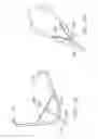 Fig. 14 - Device and method for through the scope endoscopic hemostatic clipping